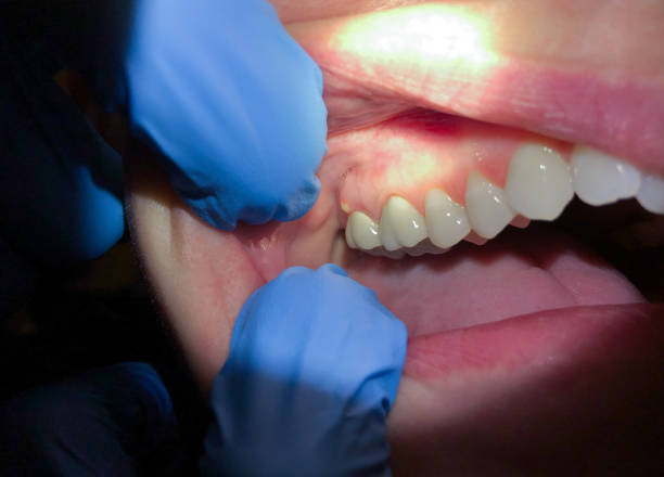Best Cosmetic Emergency Dentistry in Ashland, IL