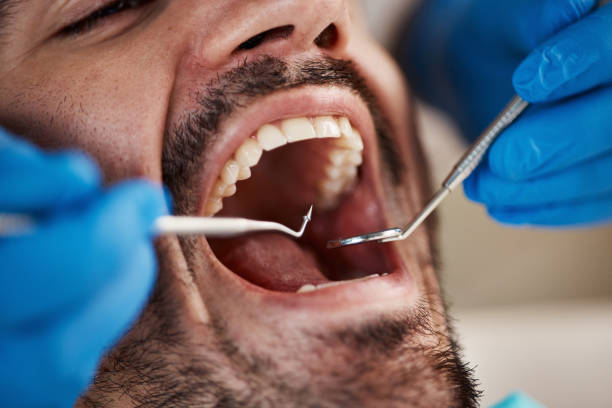 Best Pediatric Emergency Dentist in Ashland, IL