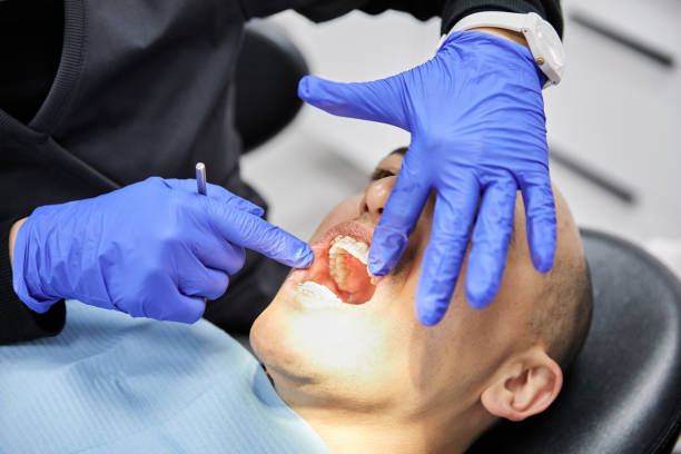 Best Emergency Dental Care for Broken or Chipped Teeth in Ashland, IL